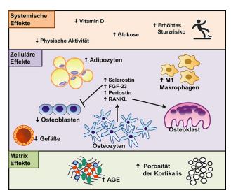 Effekte des T2DM auf den Knochenstoffwechsel. Effekte des T2DM auf den Knochenstoffwechsel.